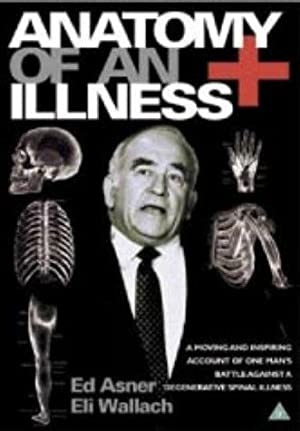 Watch Free Anatomy of an Illness (1984)